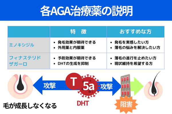 各AGA治療薬の説明