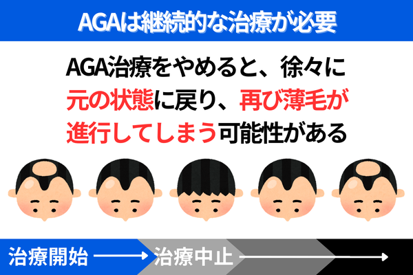 AGAは継続的な治療が必要